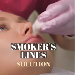 1.2M views · 1.8K reactions | Some people may think that lip...