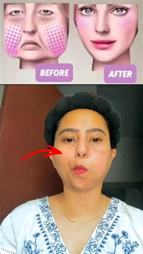 🤯3 exercises to lose chubby cheeks mouth exercise for slim face