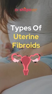 Uterine Fibroids: Types and Symptom Did you know: Uterine Fibroids are more common than you might think? These non-cancerous growths in the uterus can vary in size and location, leading to different types and symptoms. 1️⃣ Intramural Fibroids: These are the most common type, found within the muscular wall of the uterus. They can cause the uterus to become enlarged, leading to symptoms like heavy menstrual bleeding and pelvic pain. 2️⃣ Subserosal Fibroids: These fibroids grow on the outer surface