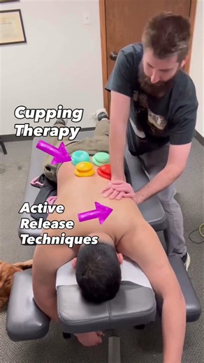 Active Release Techniques (ART) combined with Cupping Therapy #art #cup