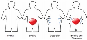 Αέρια στομάχου - εντέρου, τυμπανισμός, μετεωρισμός, φούσκωμα, ρέψιμο