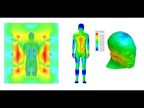 SAR simulation on MRI system with ANSYS HFSS