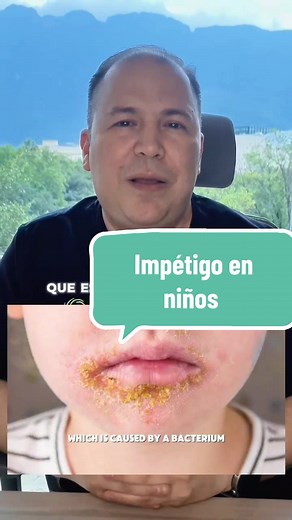 Impétigo en Niños: Cómo Identificar y Tratar