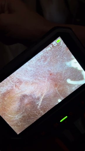 Inspection scopes are always helpful, especially on exterior walls.