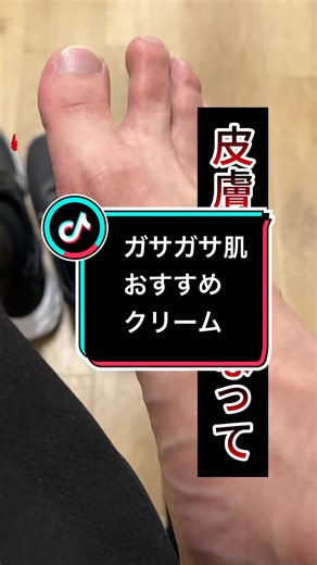 【超使える】肌がガサガサする時に使えるクリーム #尿素＃乾燥#薬局#ドラッグストア#薬剤師
