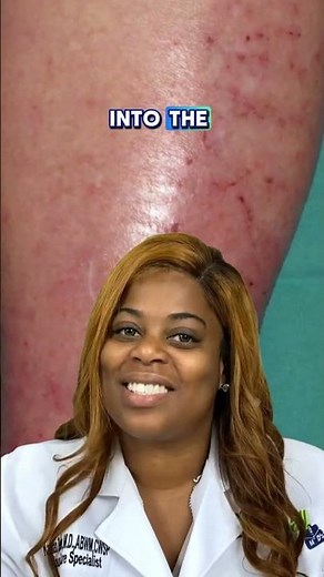 Understanding Stasis Dermatitis and Venous Insufficiency with