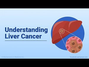 Understanding Liver Cancer
