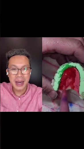 How a Hawley retainer is made | Dr Bar The Braces Doc