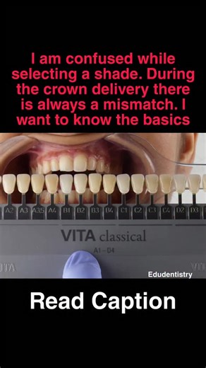 Dr.Vinayak Thorat- Dental Education | Dental shade guides are based on hue, chroma, and value, but they are not arranged in a straight light-to-dark line. This is the key reason... | Instagram