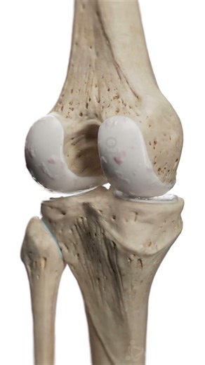 Knee arthrosis starts quietly.