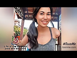 The beautiful woman with an amputated arm has a happy life with one arm #amputee