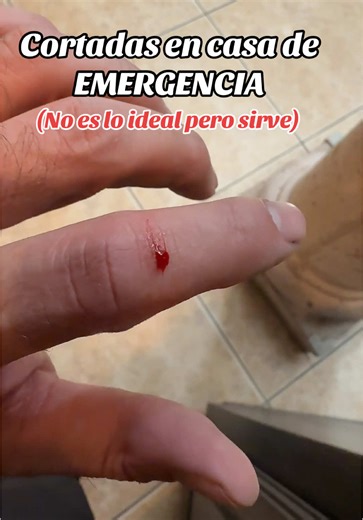 Uso de DERMABOND en Cortaduras de Emergencia