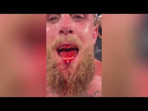 ANTHONY JOSHUA’s brutal KO of JAKE PAUL: BROKEN JAW and a DESTROYED FACE