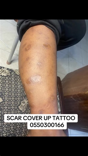 Scar tattoo cover up #0550300166 #scar #fyp #foryoupage❤️❤️ #