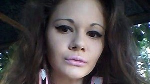 I’m unrecognisable after having 30 injections to get world’s biggest lips