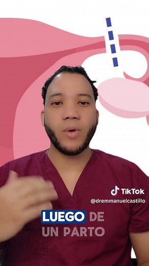 Ligadura de trompas: el procedimiento que te cambia la vida!!! #fertilidad #infertilidad #ginecologia #embarazada #ligaduradetrompas #bienestar #salud #longervideo