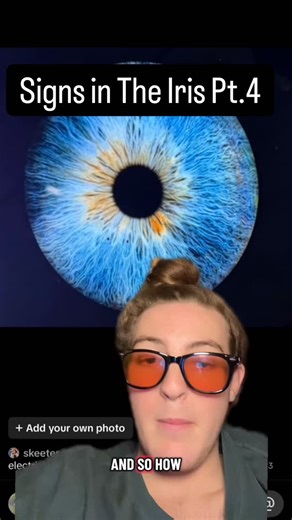 Russell | Learn To Heal Yourself⬇️ Iridology is an amazing science. It can be used to determine your weaknesses in specific tissues, your overall... | Instagram