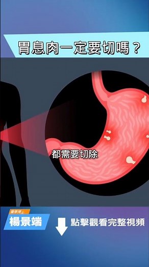 這種胃息肉一定要切除！