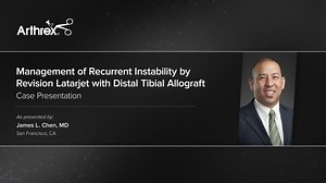 Management of Recurrent Instability by Revision Latarjet with Distal Tibial Allograft