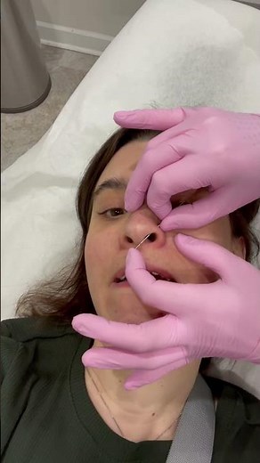 How to change a threadless labret with taper insertion pin (2 year old piercing - not fresh!)