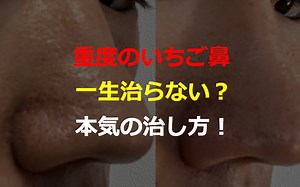 【ブログ】いちご鼻は一生治らない？何やってもダメだった重度のいちご鼻が治った4つの方法 - キヨキヨの美容ブログ