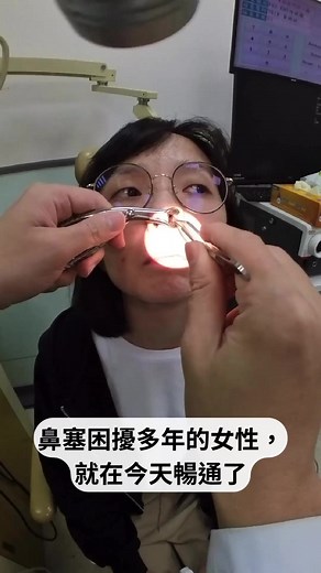 慈濟鼻塞息肉清除 | 萎縮肉治療方法分享