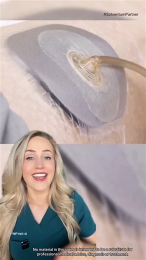 Dr. Dana Figura, DPM | #sponsored Curious how negative pressure wound therapy, aka V.A.C.® Therapy actually works? • Solventum™ V.A.C.® Therapy helps manage... | Instagram