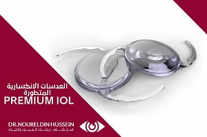 العدسات الانكسارية المتطورة (البريميم ) PREMIUM IOL 🛑️ما هي العدسات البريميم PREMIUM IOL ؟ هي عدسات لها مواصفات خاصة في صناعتها - لينة يتم زراعتها داخل العين بمحقن خاص Foldable Acrylic - طاردة للمياه Hydrophobic - بها فلتر ضد الاشعة الفوق بنفسجية UV filter 🛑️ما هي مميزات العدسات البريميم PREMIUM IOL في تصيح الابصار ؟ ١- العدسات أحادية البؤرة MONOFOCAL IOL لتصحيح قصر و طول النظر و تحسين الرؤية و صباحا و ليلا ٢- العدسات التوريكTORIC IOL لتصحيح الاستجماتيزم و يوجد منها نوعان ٣- العدسات متعددة الب