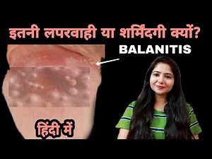 Balanitis | इतनी लपरवाही या शर्मिंदगी क्यों ? Balanitis in hindi |
