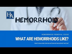 What Are Hemorrhoids Like? Want to know what Internal and External Hemorrhoids Feel Like?