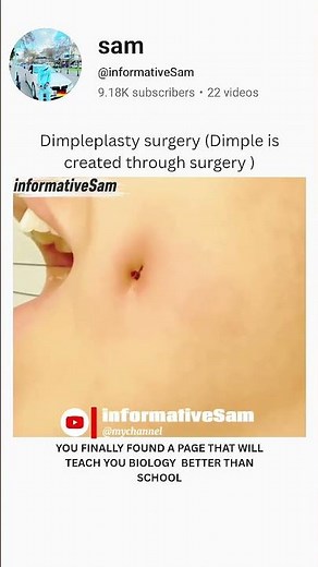 Dimple through surgery #brainlearning #biologyscience #medicaleducation