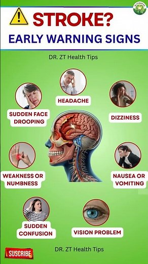 Early Warning Signs of Stroke | Your Body Warns You Before a Stroke|Dr. ZT’s Health Tips#healthtips