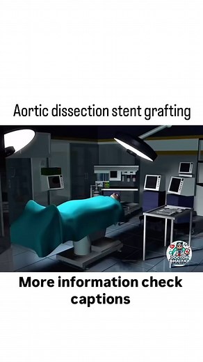 Mr. DR | Aortic stent grafting-Aortic stent grafting, also known as endovascular aneurysm repair (EVAR), is a minimally invasive procedure used to... | Instagram