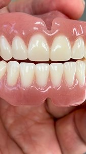 Deluxe Immediate dentures! From Dr. James S. Kim, DDS in Wisconsin! | Luke Kahng