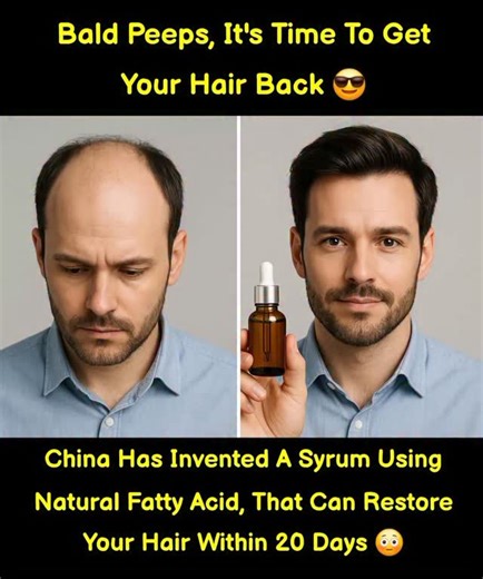 Kish18 on Instagram: "China has introduced a breakthrough hair regrowth serum made from natural ingredients that can help restore hair within just 20 days 😳. Researchers say the formula works by deeply nourishing the scalp and activating inactive hair roots, offering a gentle and effective solution for those experiencing hair loss 😍✨. #China #fblifestyle #hairtransformation #hairfall #hairfallcontrol #explore #trending #viral #reels #explorepage #reels"