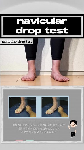 【navicular drop test】 ⁡ 究極の成長ツール ——————— 【新・臨床WEBサービス】forPT ONLINE 当たり前の知識を
