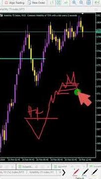 Easy VIX 75 SCALPING Strategy for Beginners