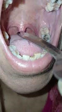 #bigmouth #uvula girl what does your UVULA DO? dangly thing back of throat mouth