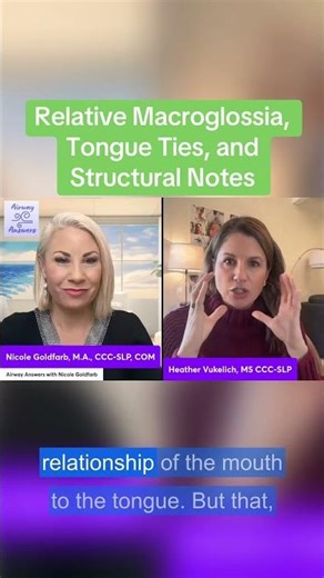 Relative Macroglossia, Tongue Ties, & Structural Notes #downsyndrome #downsyndromebaby #tonguetie #b
