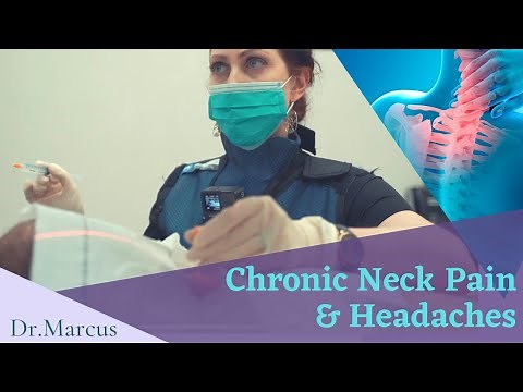 Headaches, Neck Pain? - Medial Branch Blocks (MBB)