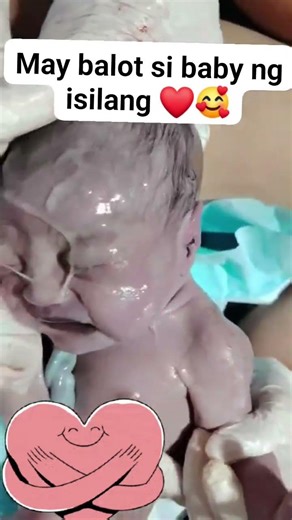 Just Delivered Little Baby 👶 #baby#adoreble #newborncare #cutebaby #adorably #newborncrying #shorts