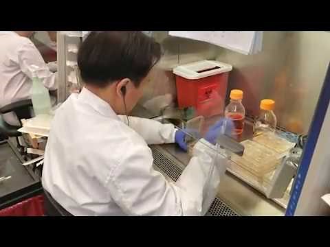 How APOE4 Contributes to Alzheimer’s Risk