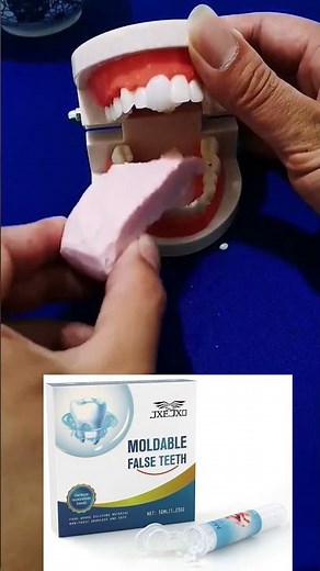 Didn’t have money for the dentist, tried a moldable teeth kit. Cheap, easy, and it actually works!