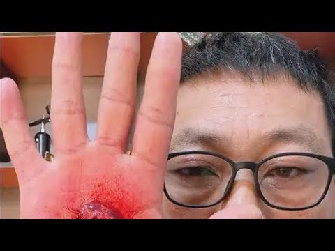 Gunshot wound makeup