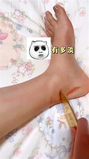 Unlock Your Health: Discover the Easy Way to Unblock Your Body's Energy Acupoint Health