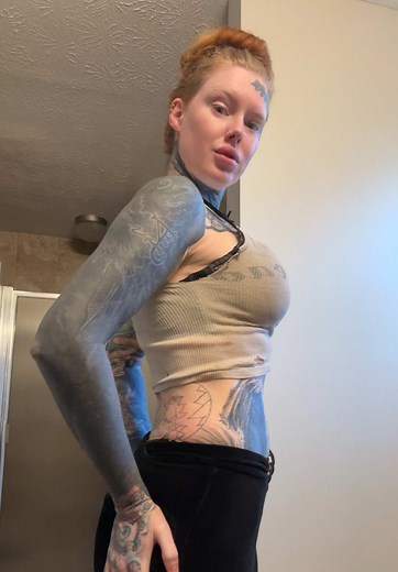 Understanding Implant Removal Surgery and Recovery