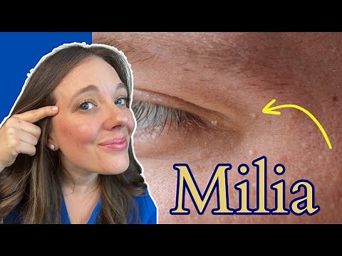 How to Get Rid of Milia | Tiny White Bumps