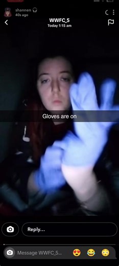 Cute sexy Snapchat girl put on some purple medical gloves#medicalgloves #latexgloves #gloves #glovelove #foryoupage