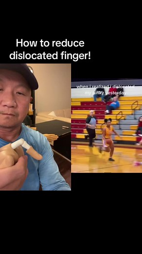 How to Reduce Dislocated Finger!