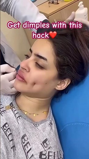 How She Got Perfect Dimples Without Surgery! #beauty
